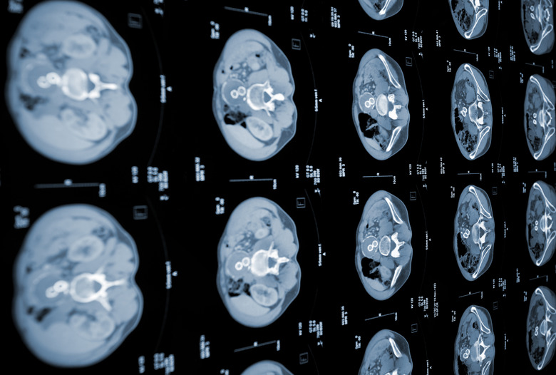 CAT scan of human abdomen